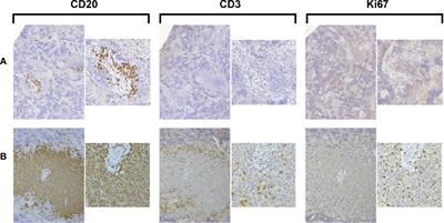 A Detailed Analysis of Parameters Supporting the Engraftment and Growth of Chronic Lymphocytic Leukemia Cells in Immune-Deficient Mice